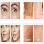 دستگاه لیفت صورت و گردن Face Lifting Massager