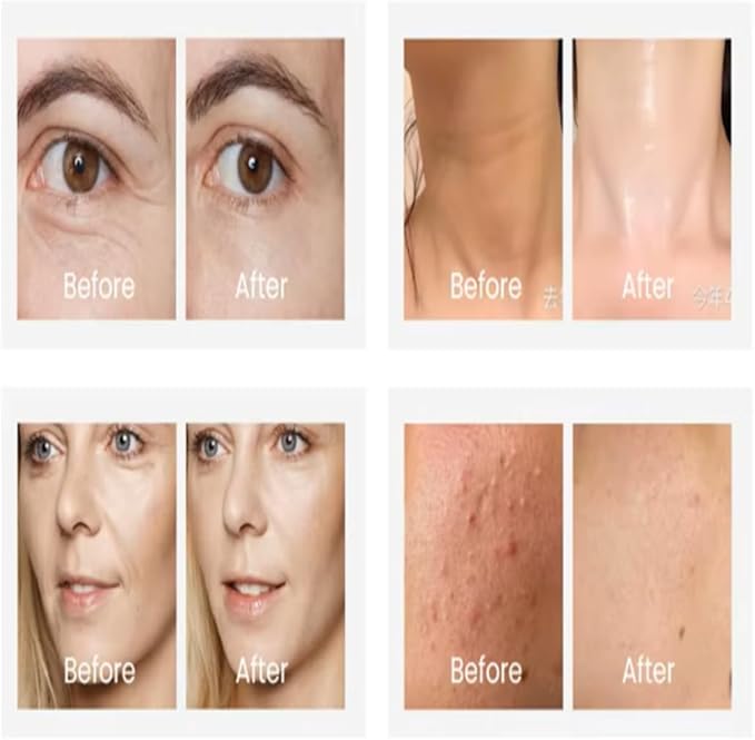 دستگاه لیفت صورت و گردن Face Lifting Massager