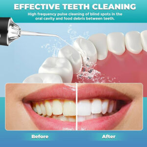 واترجت PORTABLE ORAL IRRIGATOR X3